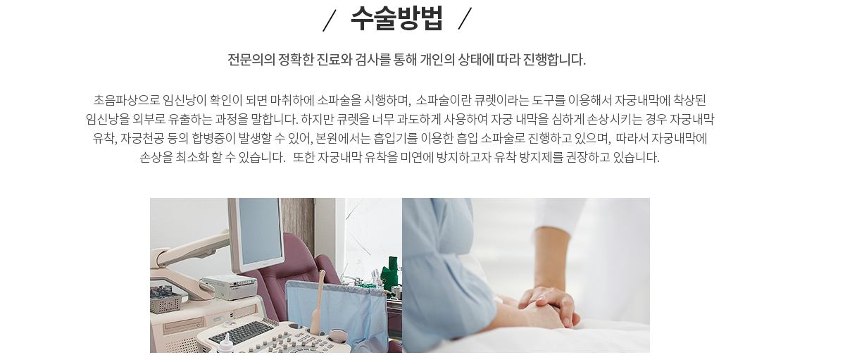 임신중절수술방법