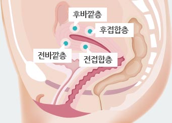 1. 전접합층 2. 후접합층 3. 전바깥층 4. 후바깥층